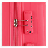 Set of 3 Highbury Murano Suitcase